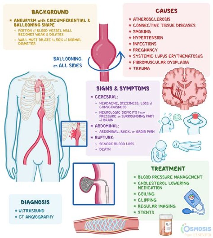 Charmaine Tumors: Understanding the Condition, Causes, Symptoms, and Treatment