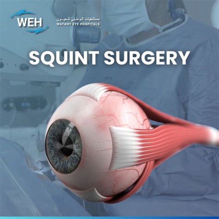 Comprehensive Guide to Strabismus Surgery: Everything You Need to Know