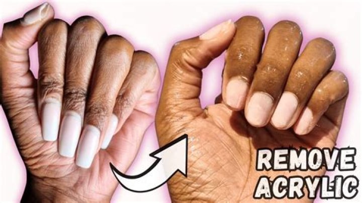 How to Remove Fake Nails Without Acetone: A Comprehensive Guide