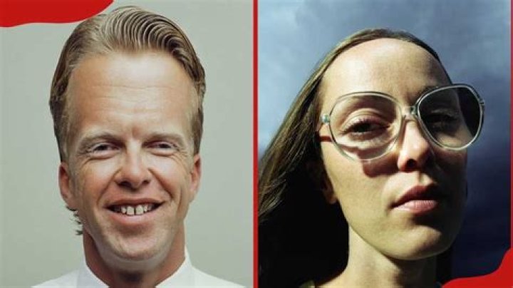 Man with Biggest Forehead: Discovering the Fascinating Story Behind This Remarkable Trait